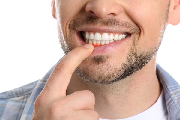 Are Asthetic Dentistry And Cosmetic Dentistry The Same?