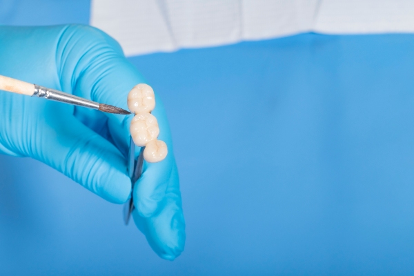 Why Dental Bridges Are Still A Smart Choice
