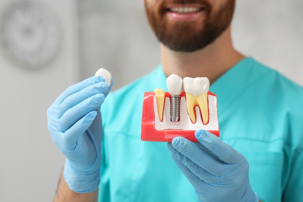 How Dental Implants Can Help Your Jawbone